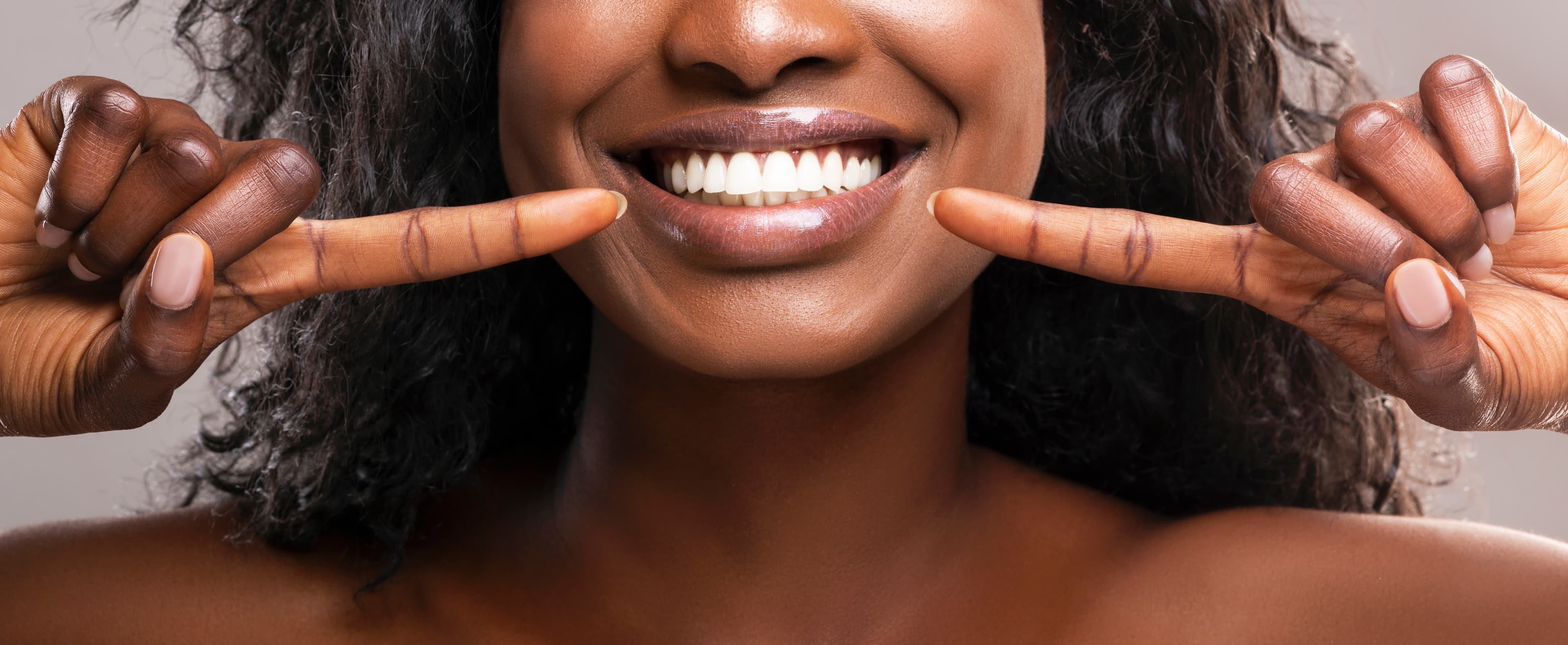 Digital Smile Design