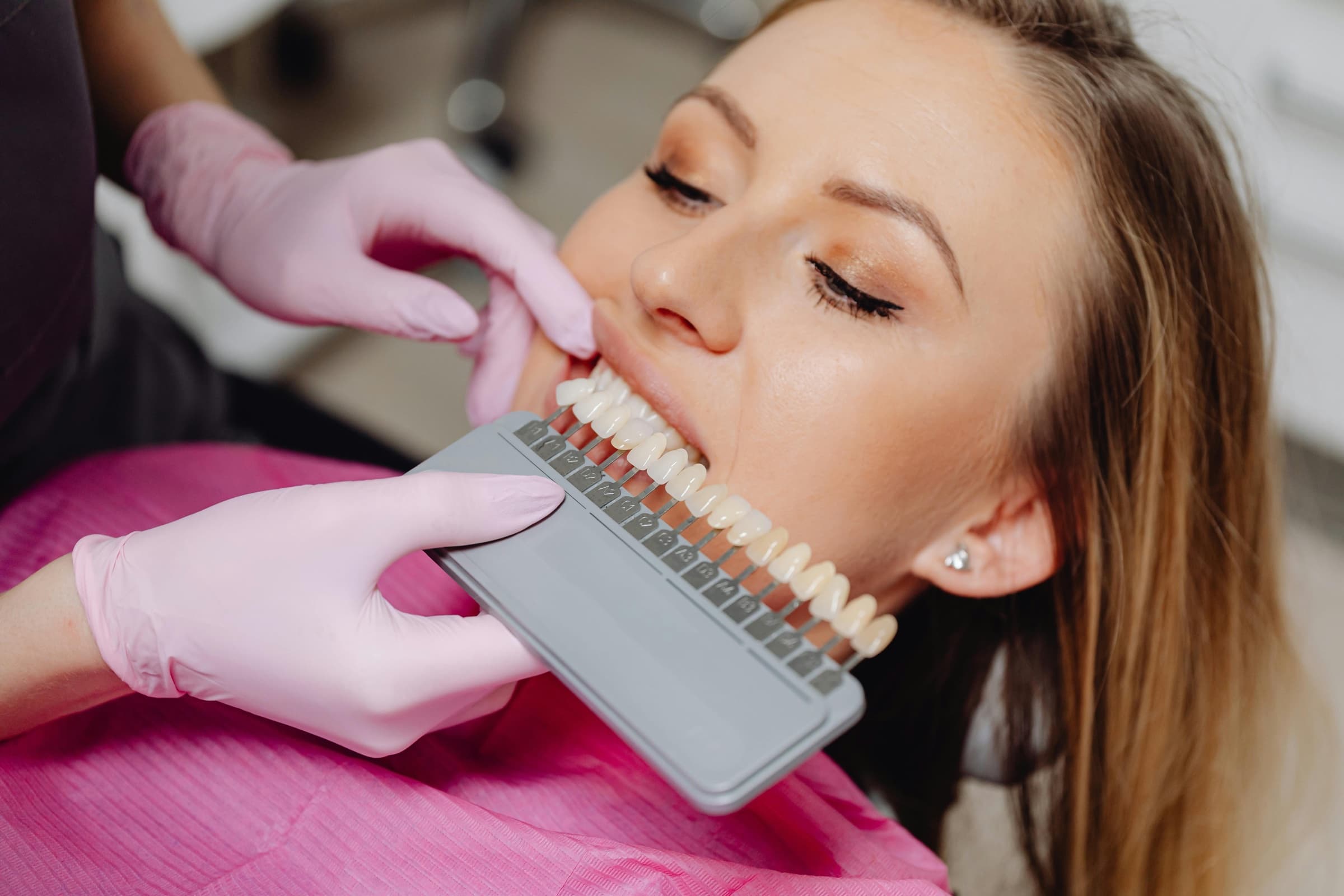 Full Mouth Veneers in a Day