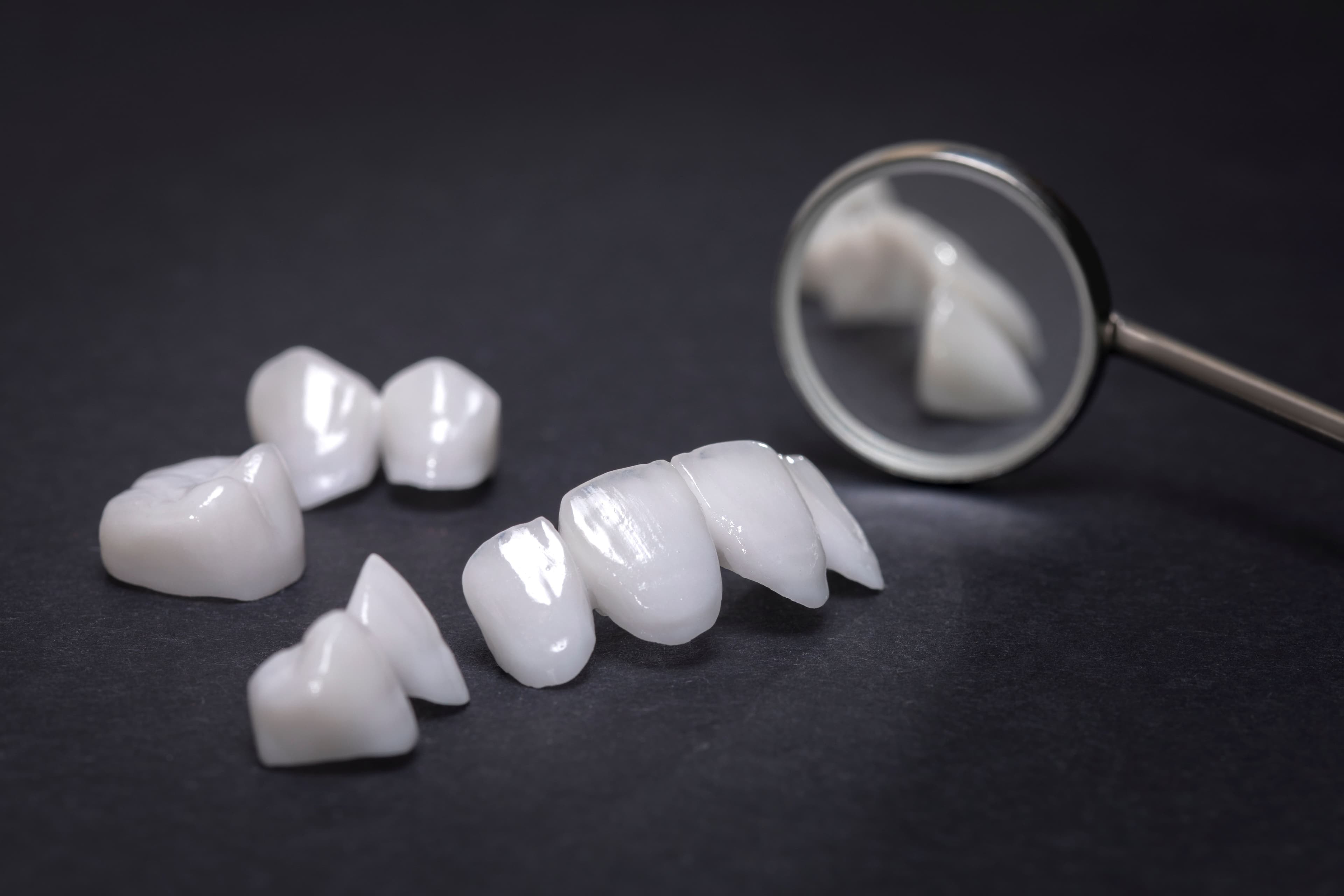Porcelain Veneers